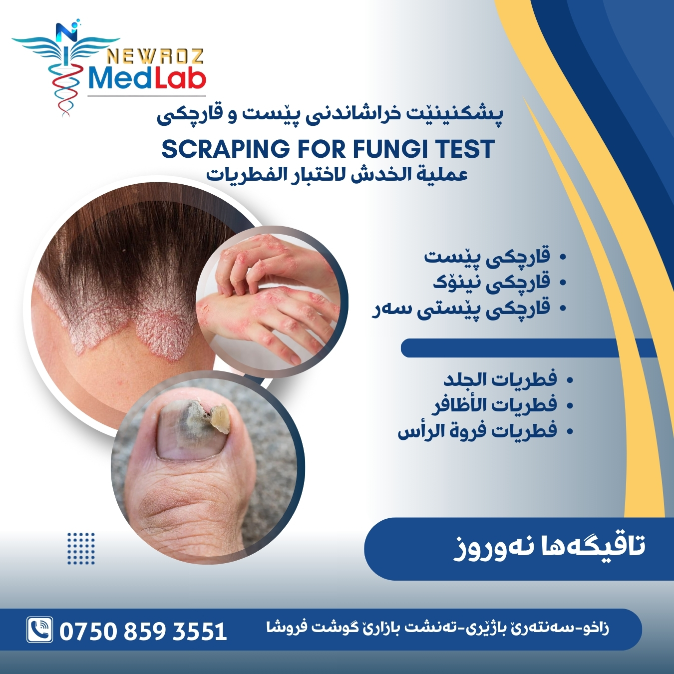 Scraping for Fungi Test