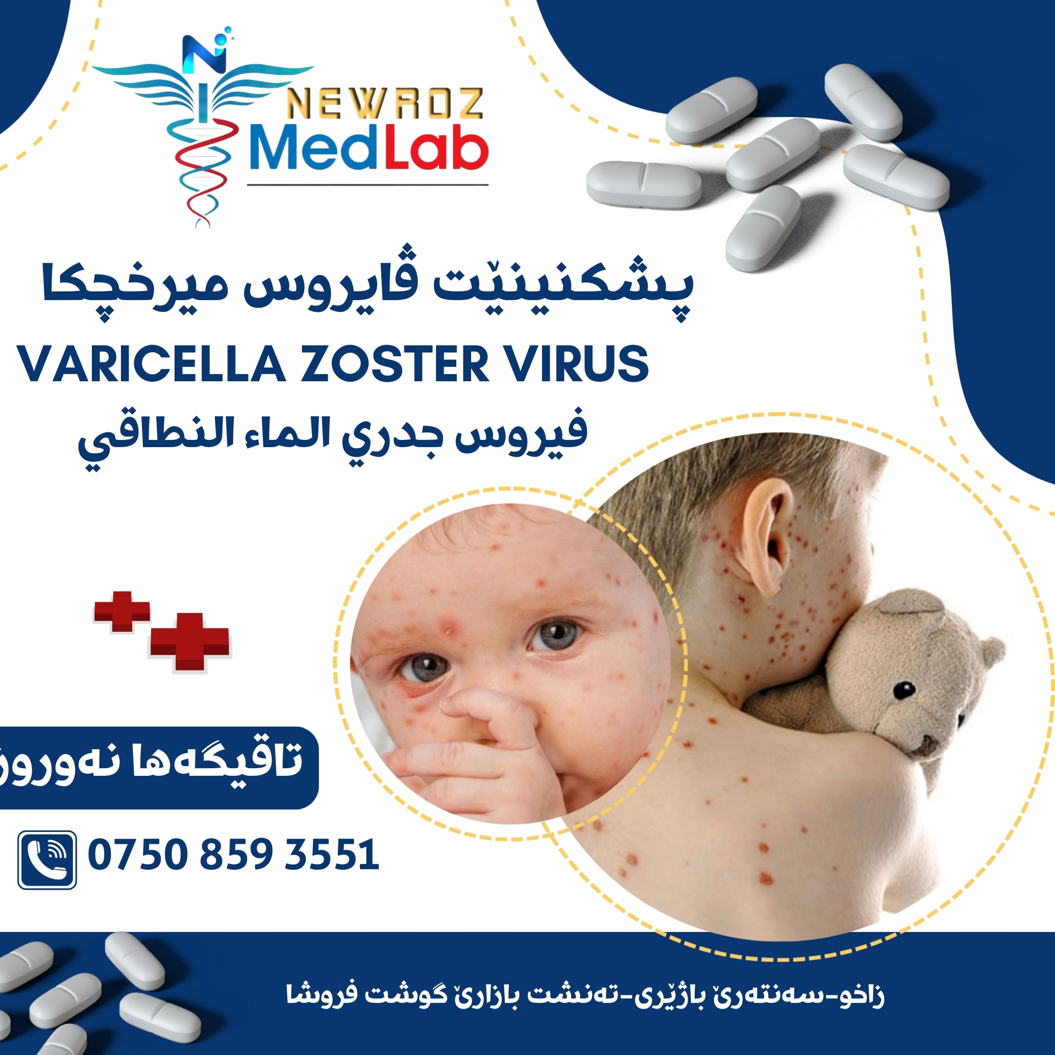 Varicella zoster virus